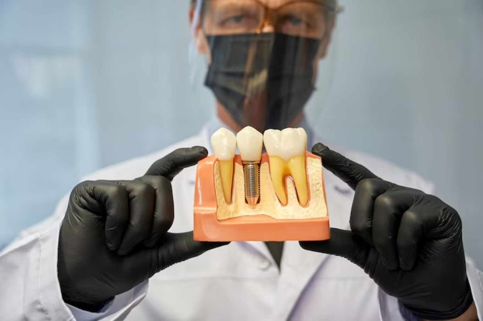 The Truth About Dental Implants: Costs, Myths & Facts
