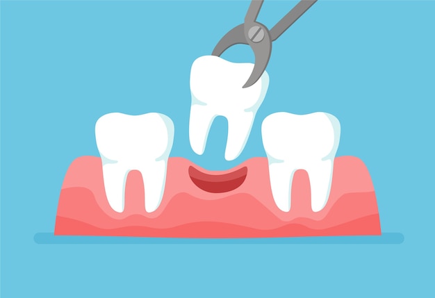 tooth extraction in hamilton